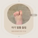 들림 - 동작구 | 발톱 들렸을때 병원 어디로 아기 발톱 들림 치료 후기