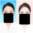 엘리자베스 서울 후기
