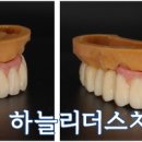 리더스치과기공소 네이버블로그