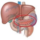 배가 아파요! 만성 췌장염, 급성 췌장염 원인 및 증상 이미지