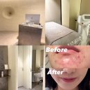 행운약국 | 구원자 압출의신 부산 레오아에스테틱 n번째 방문후기👩🏻‍💻🧴 세상 사람들 다 갔으면 .. +) 비포애프터 및...
