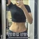 포레성형외과