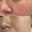 아벨라 파메스테틱 홈케어코칭 안내