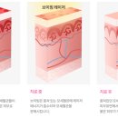 수브이