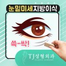 티제이성형외과의원 | 눈밑지방재배치잘하는곳 티제이성형외과에서 상담 받아보세요 !