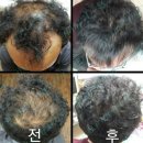 360헤어 이미지