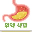 위액색깔 초록색 위액 노란 구토 이미지