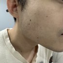 클린프릭 이미지