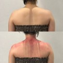 중앙동309 | 창원 목어깨마사지 중앙동 오유브이(OUV)에스테틱 넥숄더테라피 후기