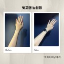 노원-상계-2250 | 노원역화이트태닝 추천! 벗고탠 노원점 노원화이트태닝 솔직 후기