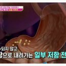 보청기프로 이미지