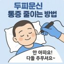 4615 | [세종 두피문신] 두피문신 시술 시 통증은 어느 정도일까?