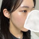 백피부과의원 | W12. 본식 한달전 피부과시술 “리오셀의원” 찐내돈내산 ㅣ 리쥬란, 콜라겐, 필러, 승모근보톡스