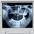 꿈나무 약국 | 잇몸 좀비 탈출기! 홍제 365 치과 다녀온 썰 푼다