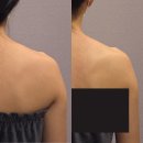 호계동 1047-1 R | 안양 범계 신부관리 씨엘오비스 웨딩 프리미엄으로 관리 시작 전후 비교