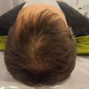 완산구청 | 얼굴부터 바디까지 토탈 케어! 완산구 피부관리 잘하는 곳 올가드림뷰티 완산구청점 후기