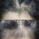 브로우기프트