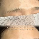다움스킨 이미지