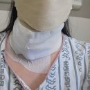 동아대학교병원 | 이제야 털어놓는 갑상선암수술후기-동아대학교병원