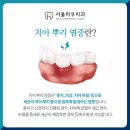 하우치아