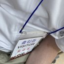 관골 | 2023.06.1주 [광대뼈골절, 안와골절, 관골골절, 안면골절 후기]
