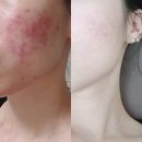 이오스타 이미지