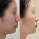 용카마스터 | 뭉친 근육 풀고 작아지는 얼굴경락마사지