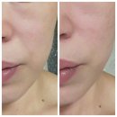 케어셀라 지쿱 | 지쿱 케어셀라 리프팅겔 사용후기