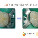 미듬치과 네이버블로그