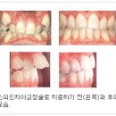 라인치과 네이버블로그