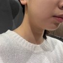 문정역 온오프피부과 온다리프팅 내돈내산 후기(+통증, 효과)