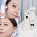 명품피부 | 피부 홈케어 기기 추천 림핏프로 사용후기, 제이엘유 명품 홈케어 기기