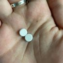 오즈성형외과의원 | 눈밑에 피지낭종 제거한 후기 (내돈내산) +추가 흉터사진