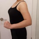 일등병원 | 람스 팔뚝 후기 근육형 팔뚝 효과 운동 언제부터