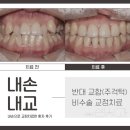 내손치과의원 네이버블로그