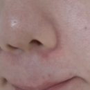 세계로약국 | 여드름 앰플 약국 여드름 화장품 추천! 코페르 큐리페어 더마앰플 후기