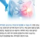 간경변증 문맥 고혈압 복수 발생 원인 증상 복막염 원인 이미지