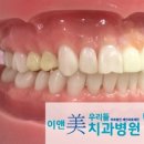 우리들치과기공소 이미지