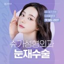 슈가성형외과의원 | 눈재수술 쌍꺼풀수술 고민될대 슈가성형외과