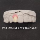 우주치과기공소 이미지