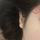 다올메디칼 | 천호동 천호역 피부관리 여드름 피부관리 다올뷰티 피부 케어 후기