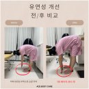 에이스바디 | [구래동 체형관리] '에이스바디케어' 후기 – 어깨 움직임까지 좋아진 김포 마사지