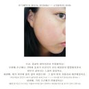 르네셀 사용전.후 비교사진 모음 이미지