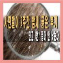 하얀성모텔 | 사면발이 연고 한 번 믿었다가 2주간 밤새 긁은 솔직 후기