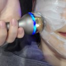 울쎄라 1년만에 한 후기 울세라 300샷 효과 부작용 등 총정리