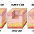 신논현역 이미지