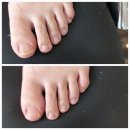 발톱닥터