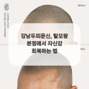 탈모왕 본점 이미지