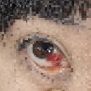 군산안과의원 이미지