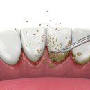 이바른치과의원 이미지